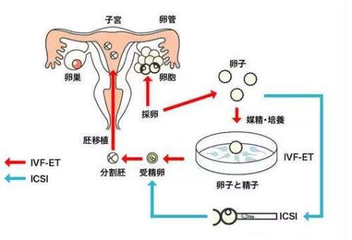 双顶径