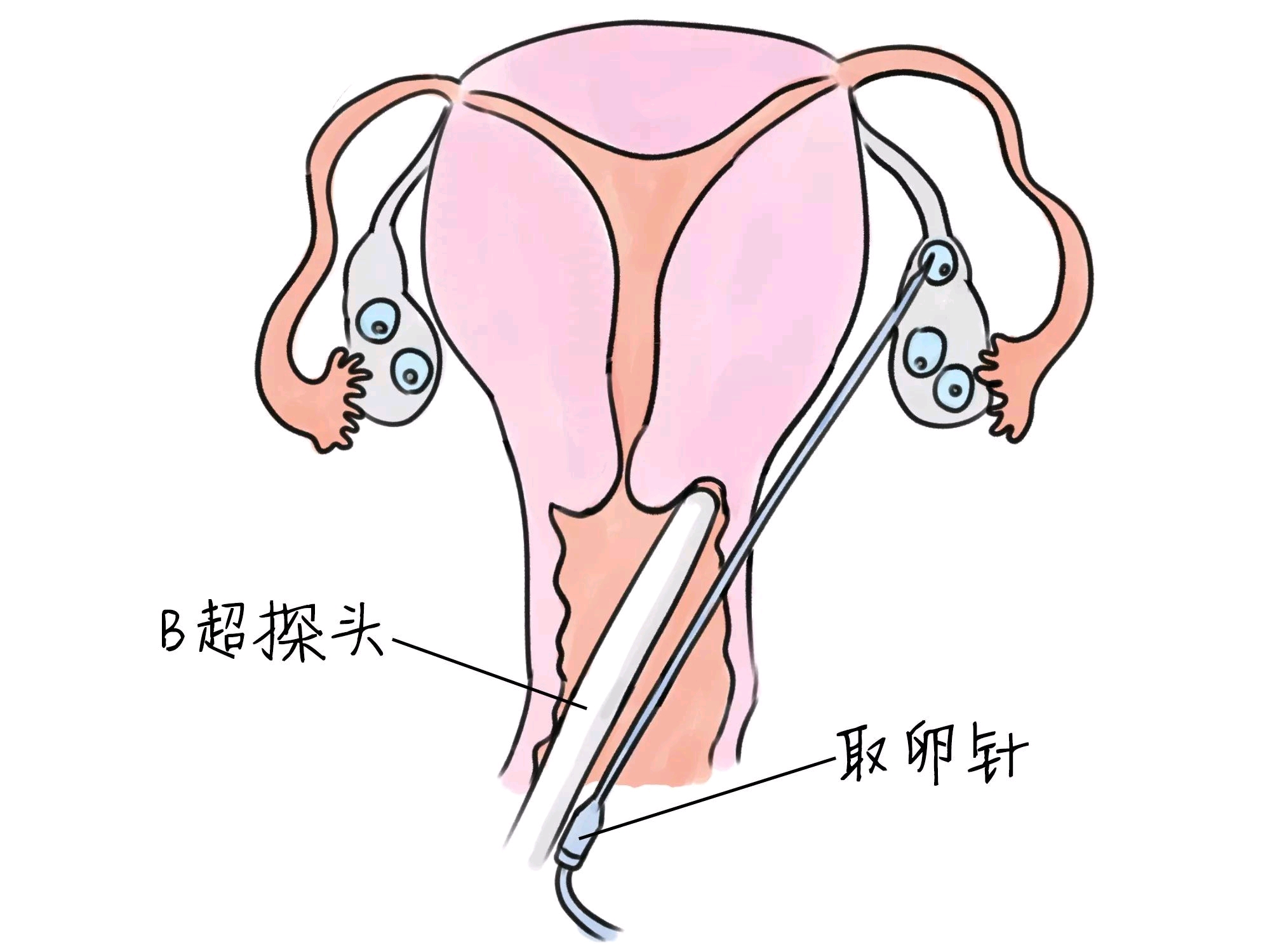 受精卵着床