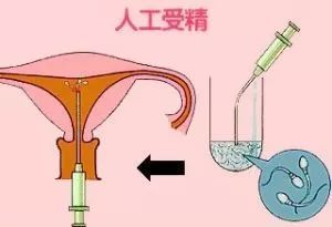 受精卵着床