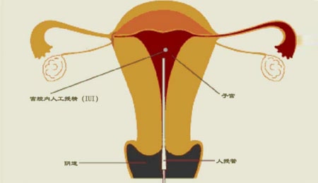 古代怀孕年龄