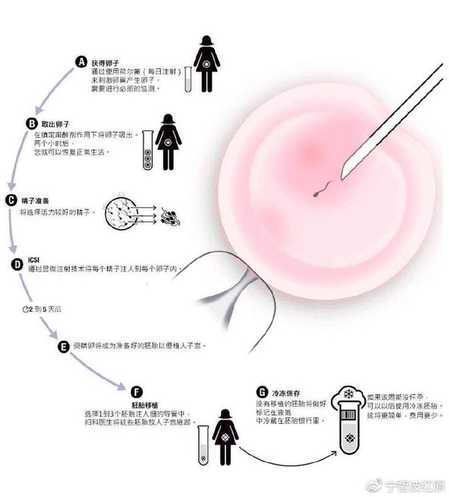 受精卵着床