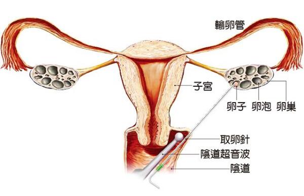 受精卵着床