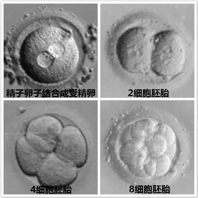 早孕反应