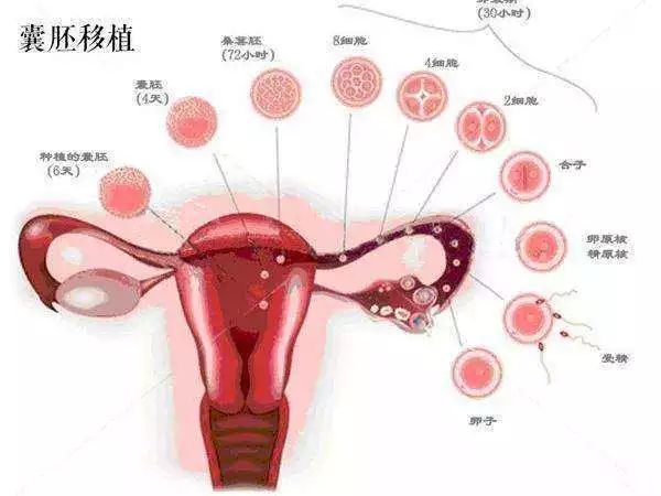 右侧输卵管异位妊娠
