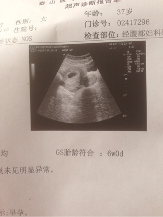 受精卵着床
