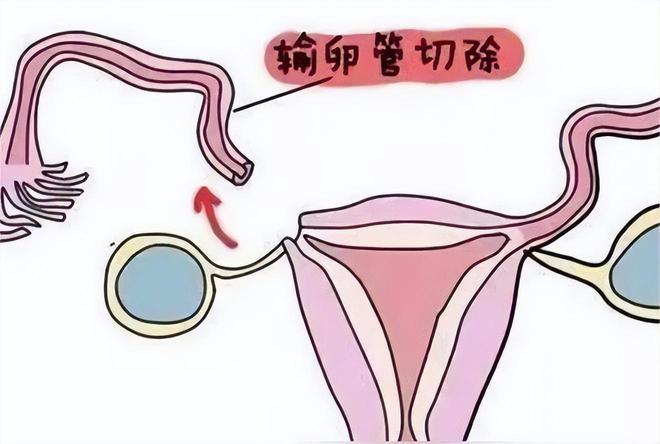 受精卵着床