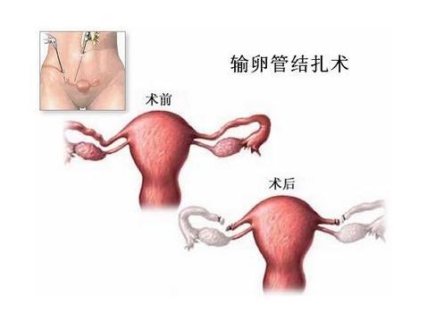 受精卵结合