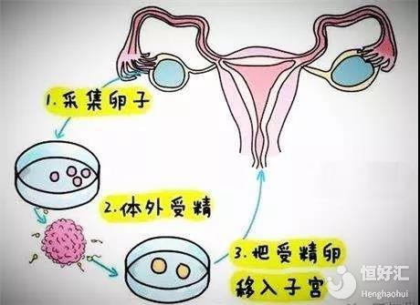 受精卵着床出血