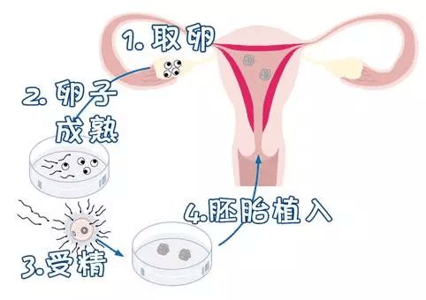 天津捐卵机构
