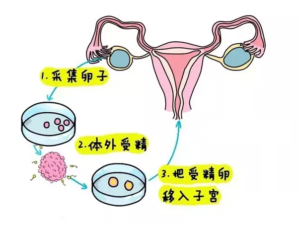 天津供卵代怀